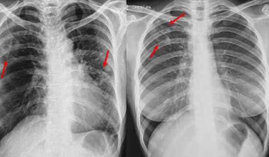 RESPIRATORY MEDICINE
